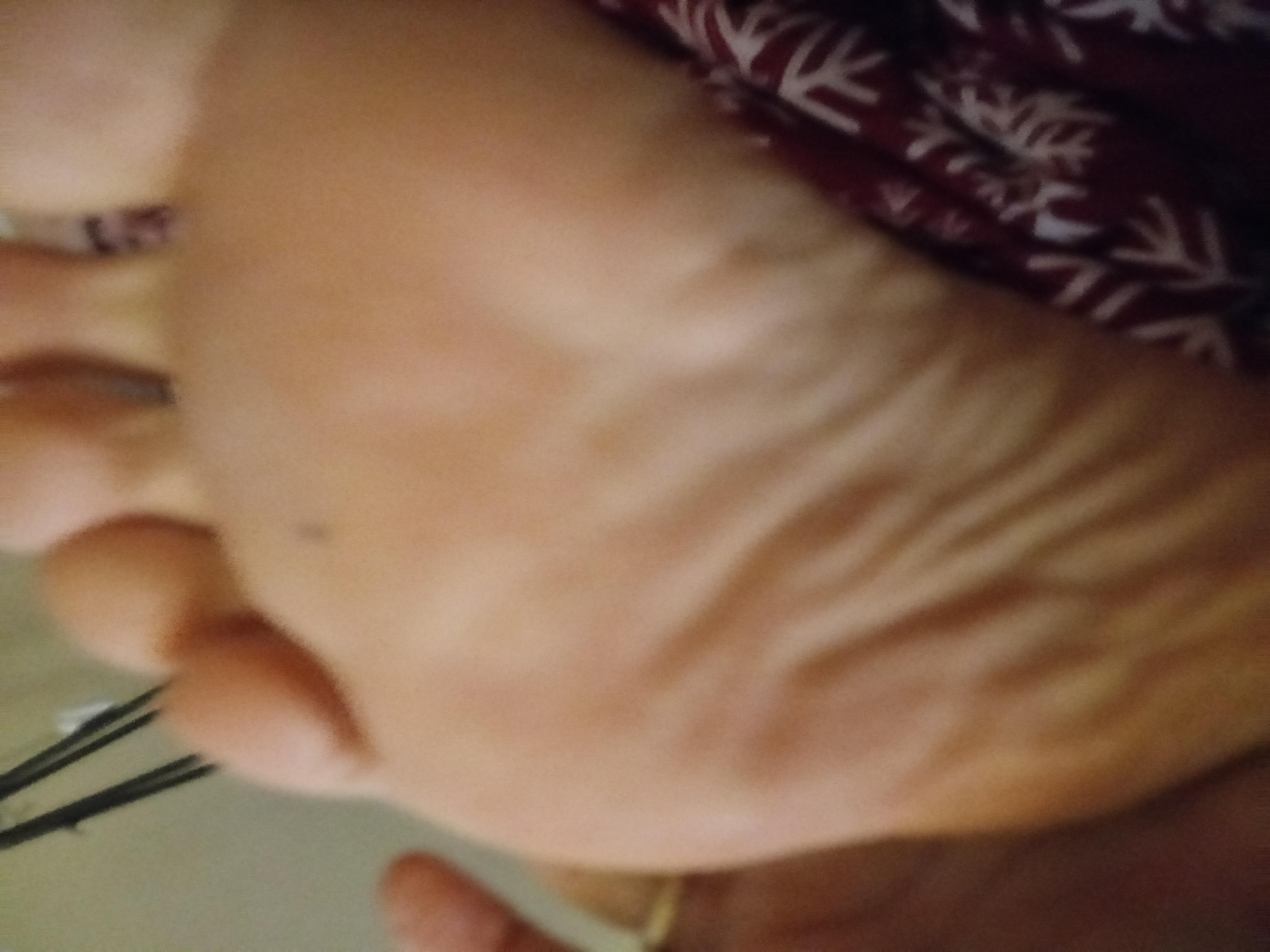 Smooth feet